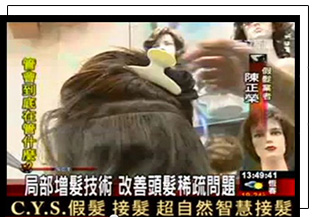 活動式接髮髮片