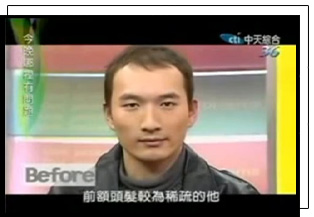 禿髮稀疏