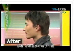 局部髮片