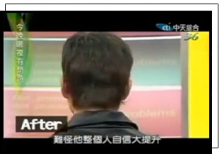 頭髮濃密